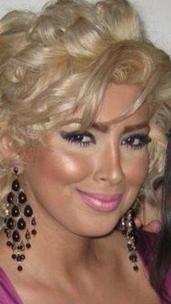 Melissa - Professional beauty portfolio image 11 showcasing aesthetic treatments and artistry